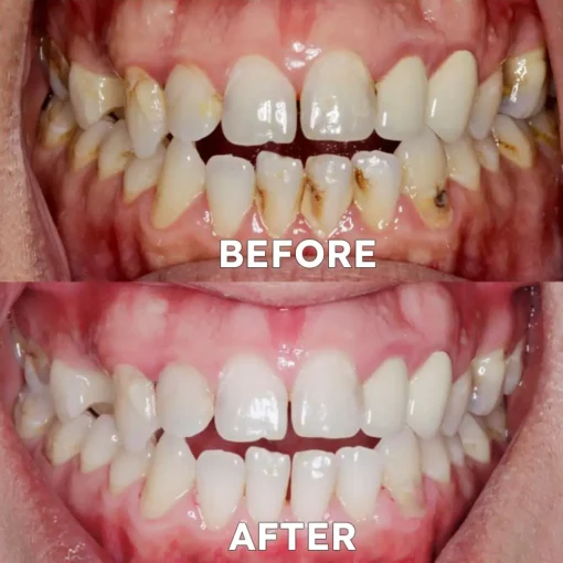 Ourlyard™ Teeth Restoration Mineral Powder - Image 5